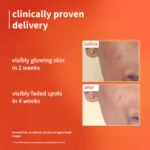 1% Vitamin C Ultra-Light-Glow Boosting Gel Cream with Alpha Arbutin - Image 5