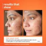 10% Vitamin C Barrier Boosting + Glow Serum with Calendula - Image 3