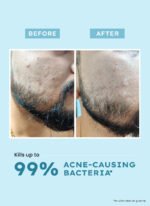 Clarifying Acne Cleanser with 2% Salicylic Acid - 100 ml - Image 4