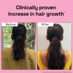 3X Rosemary for Hair Fall - Image 3