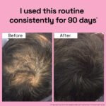 3X Rosemary for Hair Fall - Image 6