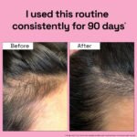 2X Rosemary for Hair Fall Control + Hair Growth Boost - Image 6