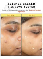 10% Vit C Serum with 1% Vit E & Ferulic Acid | Clinically Tested - Image 8
