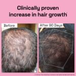 Rosemary Redensyl Hair Growth Serum - Image 3
