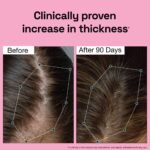 Rosemary Redensyl Hair Growth Serum - Image 4