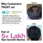 Soulflower Rosemary Lavender Hair Growth Oil – Natural Vegan Hair Oil for Stronger Hair - Image 3