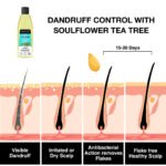 Complete Routine for Excessive Dandruff - Image 9