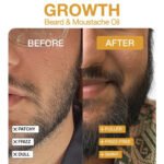 Beard & Moustache Oil for Macho Men - Image 7