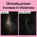 Soulflower Rosemary Essential Oil for Hair Growth – 100% Pure Natural Oil (30ml) - Image 3