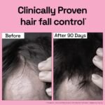 Soulflower Rosemary Essential Oil for Hair Growth – 100% Pure Natural Oil (30ml) - Image 4
