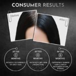Iba No More Grey Hair Serum (Pack of 2 ) - Image 6