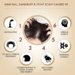 Iba Anti-Dandruff Black Seed Therapy Shampoo & Conditioner Combo - Image 5